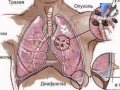 4 февраля – Всемирный день борьбы с онкологическими заболеваниями